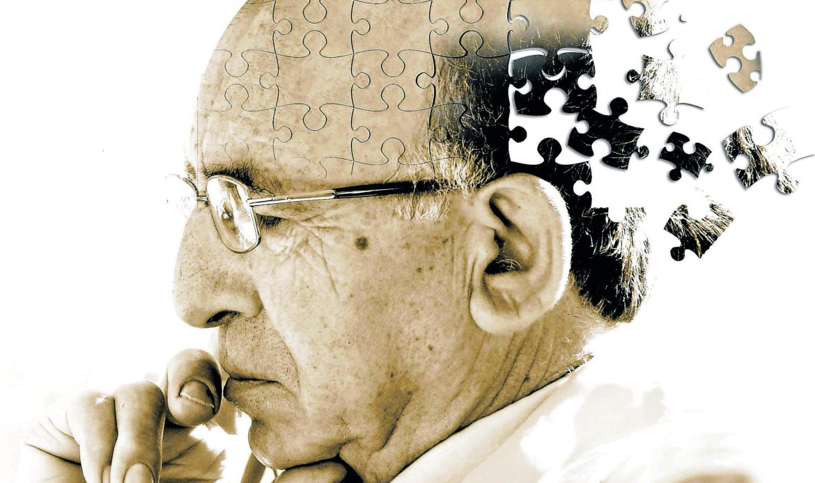 Con un nuevo dispositivo podrán reducirse los síntomas del Alzheimer 