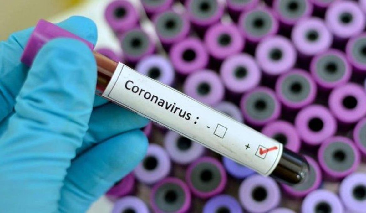 Secretaría de Salud informa acciones de preparación y respuesta ante nuevo coronavirus (2019- nCoV) para la protección de la salud