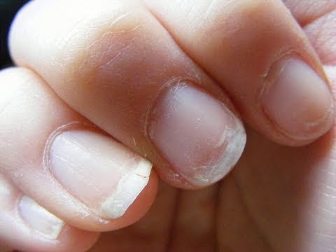 7 tratamientos caseros para fortalecer las uñas débiles