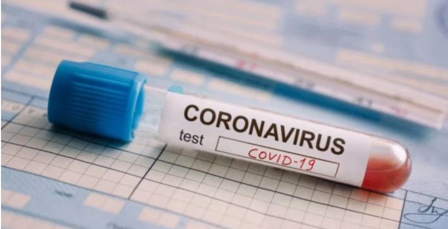 ¿Qué seguros de gastos médicos cubren la prueba de Coronavirus?