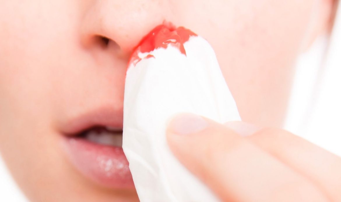 ¿Por qué puede sangrar la nariz sin motivo aparente?