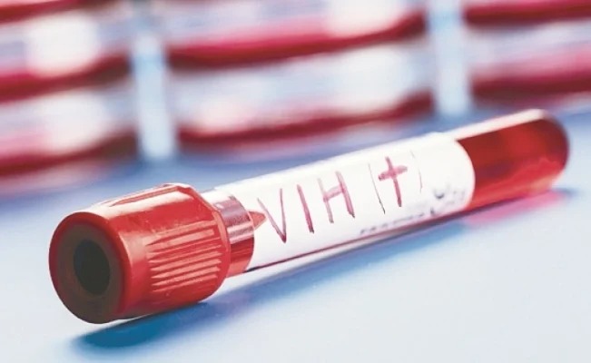 En brasil paciente supera VIH