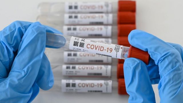 Registra Querétaro 412 nuevos casos de COVID-19