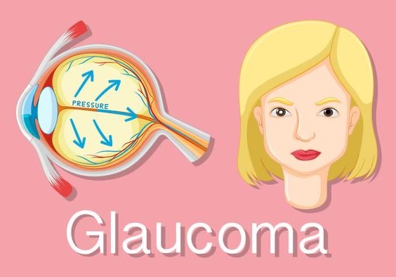Se suma SESA a la conmemoración del Día Mundial del Glaucoma
